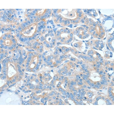 Immunohistochemistry - AGO2 Antibody from Signalway Antibody (36062) - Antibodies.com