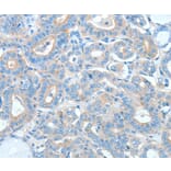Immunohistochemistry - AGO2 Antibody from Signalway Antibody (36062) - Antibodies.com