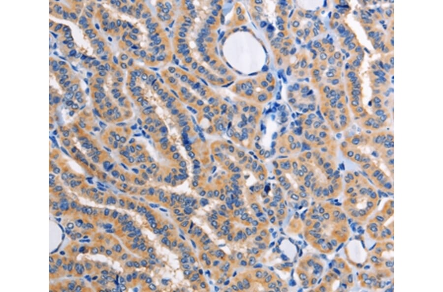 Immunohistochemistry - ALG8 Antibody from Signalway Antibody (36080) - Antibodies.com