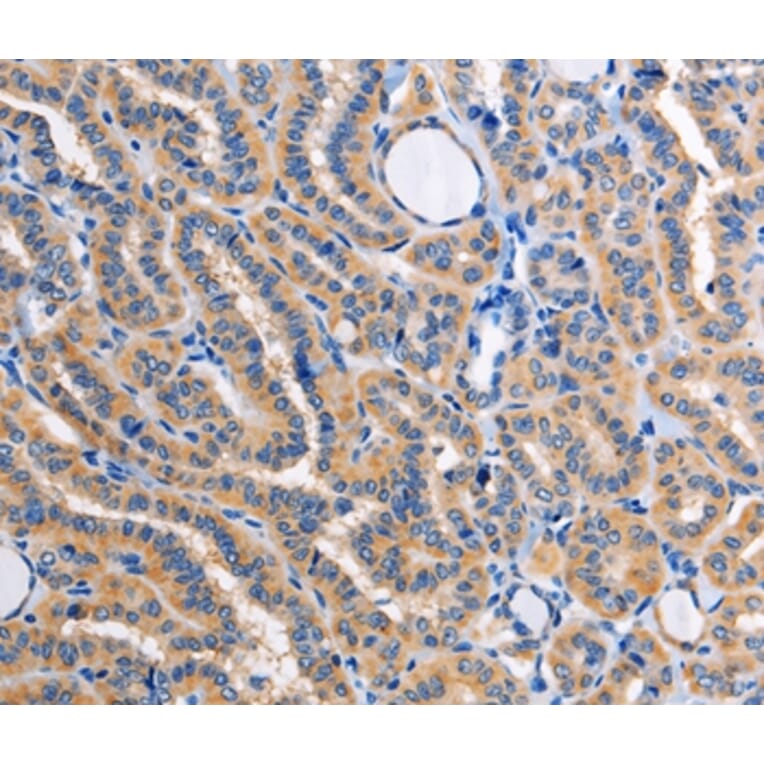 Immunohistochemistry - ALG8 Antibody from Signalway Antibody (36080) - Antibodies.com