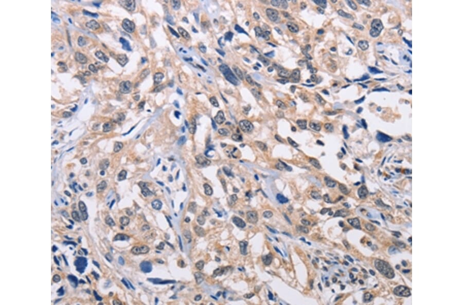 Immunohistochemistry - ALG8 Antibody from Signalway Antibody (36080) - Antibodies.com