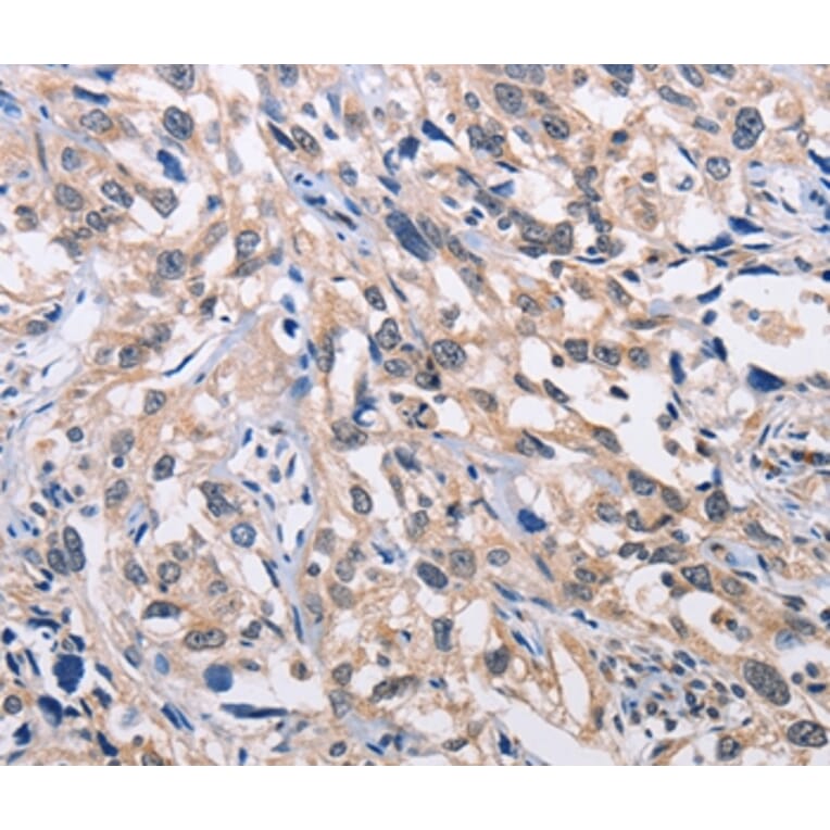 Immunohistochemistry - ALG8 Antibody from Signalway Antibody (36080) - Antibodies.com