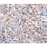 Immunohistochemistry - ALG8 Antibody from Signalway Antibody (36080) - Antibodies.com