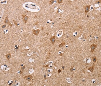 Immunohistochemical analysis of paraffin-embedded Human brain tissue using #36081 at dilution 1/60.