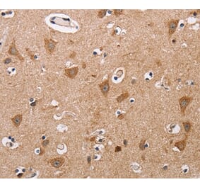 Immunohistochemistry - ALG9 Antibody from Signalway Antibody (36081) - Antibodies.com