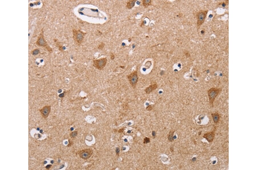 Immunohistochemistry - ALG9 Antibody from Signalway Antibody (36081) - Antibodies.com