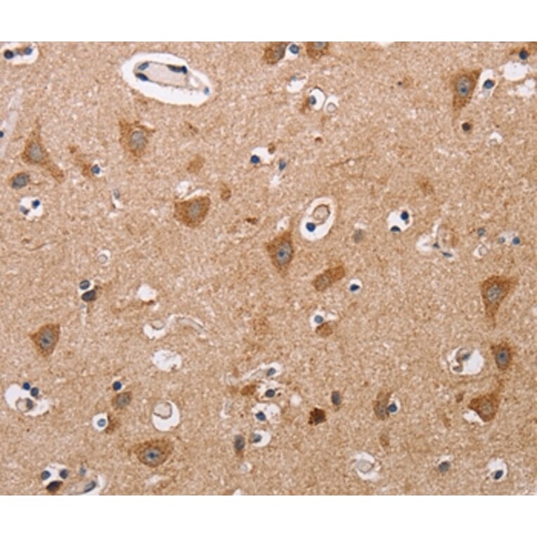 Immunohistochemistry - ALG9 Antibody from Signalway Antibody (36081) - Antibodies.com