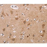 Immunohistochemistry - ALG9 Antibody from Signalway Antibody (36081) - Antibodies.com