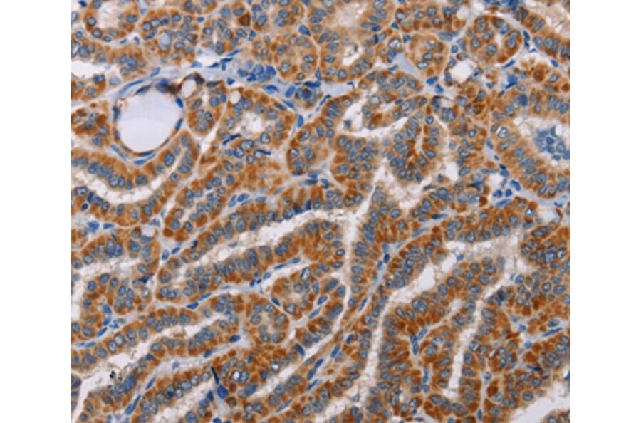 Immunohistochemistry - ALG9 Antibody from Signalway Antibody (36081) - Antibodies.com