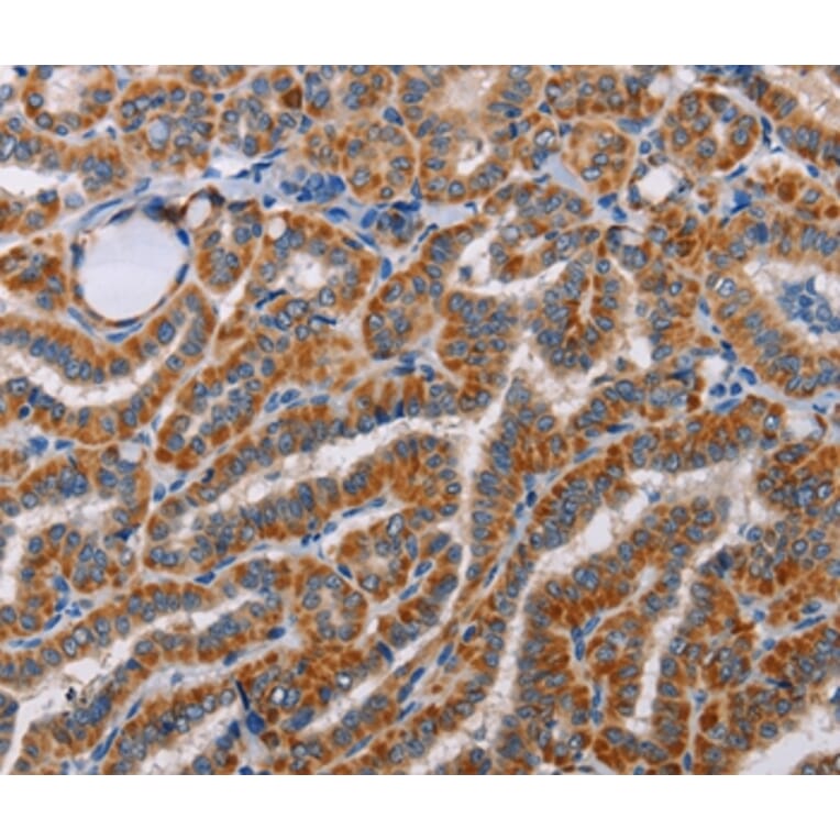 Immunohistochemistry - ALG9 Antibody from Signalway Antibody (36081) - Antibodies.com