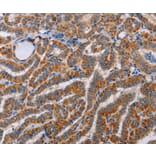 Immunohistochemistry - ALG9 Antibody from Signalway Antibody (36081) - Antibodies.com