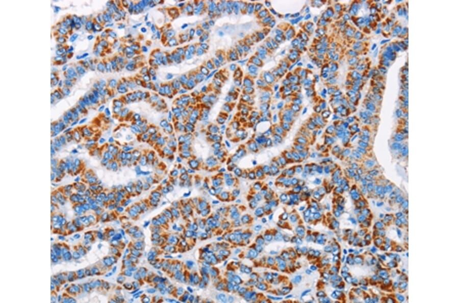 Immunohistochemistry - ALG2 Antibody from Signalway Antibody (36082) - Antibodies.com