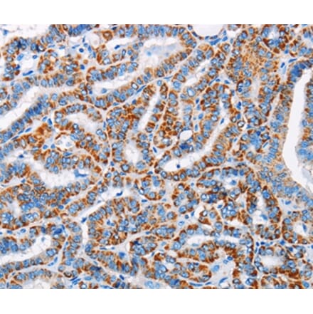 Immunohistochemistry - ALG2 Antibody from Signalway Antibody (36082) - Antibodies.com