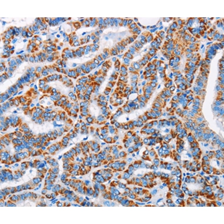 Immunohistochemistry - ALG2 Antibody from Signalway Antibody (36082) - Antibodies.com