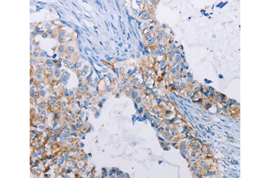Immunohistochemistry - ALG2 Antibody from Signalway Antibody (36082) - Antibodies.com