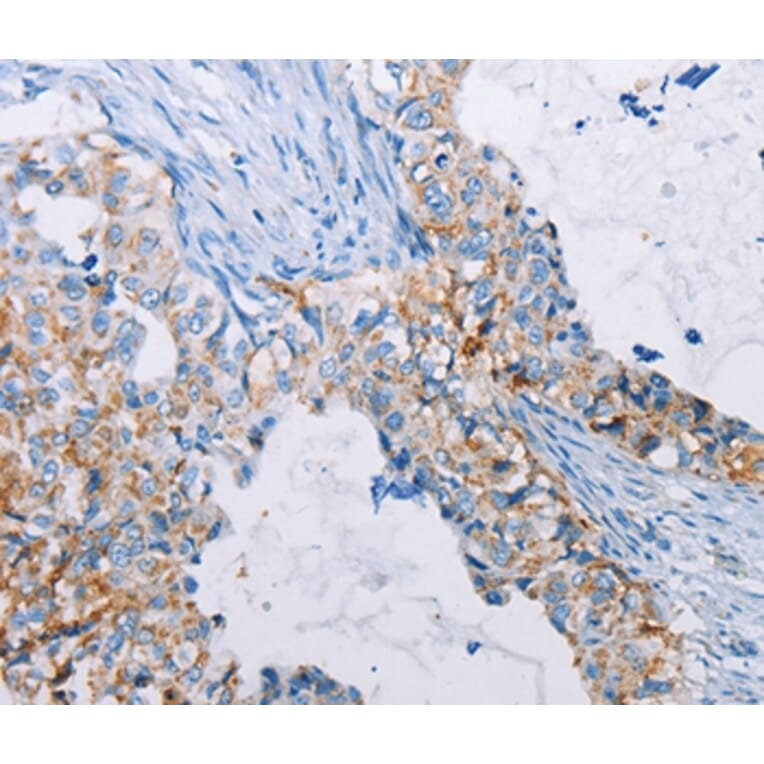 Immunohistochemistry - ALG2 Antibody from Signalway Antibody (36082) - Antibodies.com