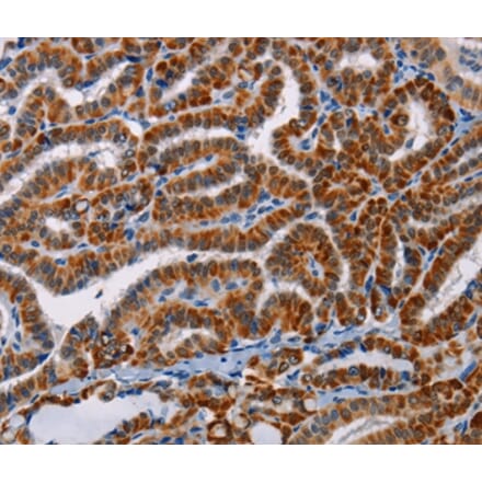Immunohistochemistry - AGPS Antibody from Signalway Antibody (36083) - Antibodies.com