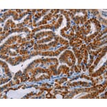 Immunohistochemistry - AGPS Antibody from Signalway Antibody (36083) - Antibodies.com