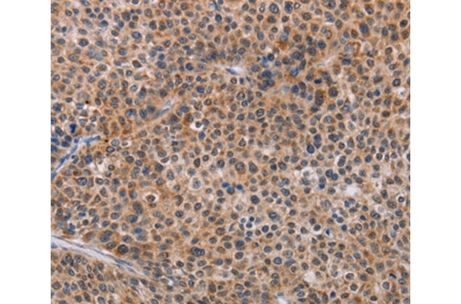 Immunohistochemistry - AGPS Antibody from Signalway Antibody (36083) - Antibodies.com
