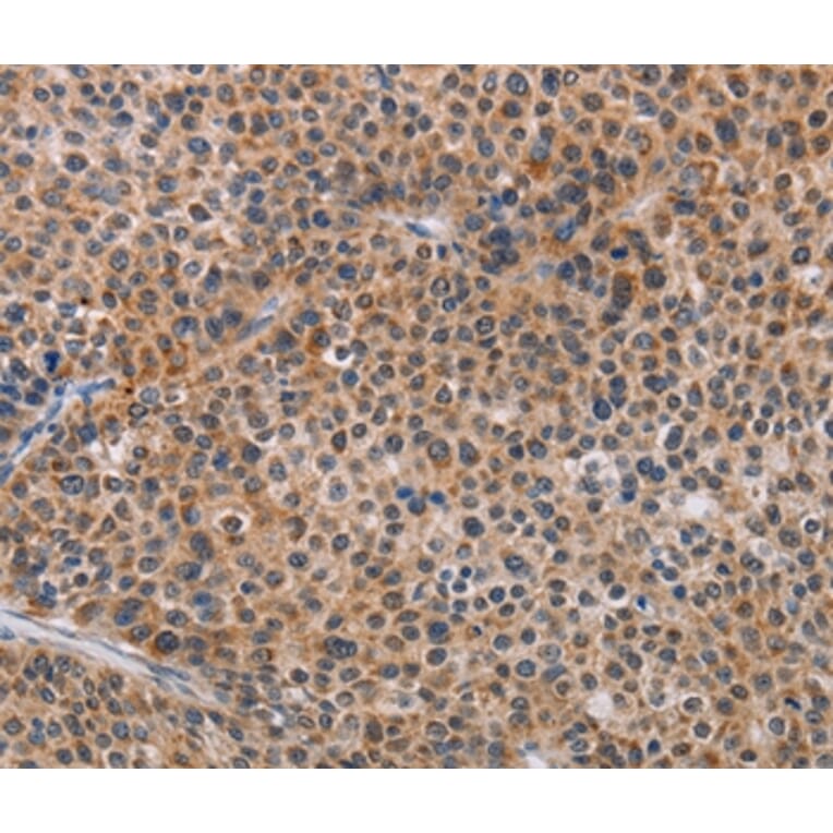 Immunohistochemistry - AGPS Antibody from Signalway Antibody (36083) - Antibodies.com