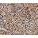 Immunohistochemistry - AGPS Antibody from Signalway Antibody (36083) - Antibodies.com
