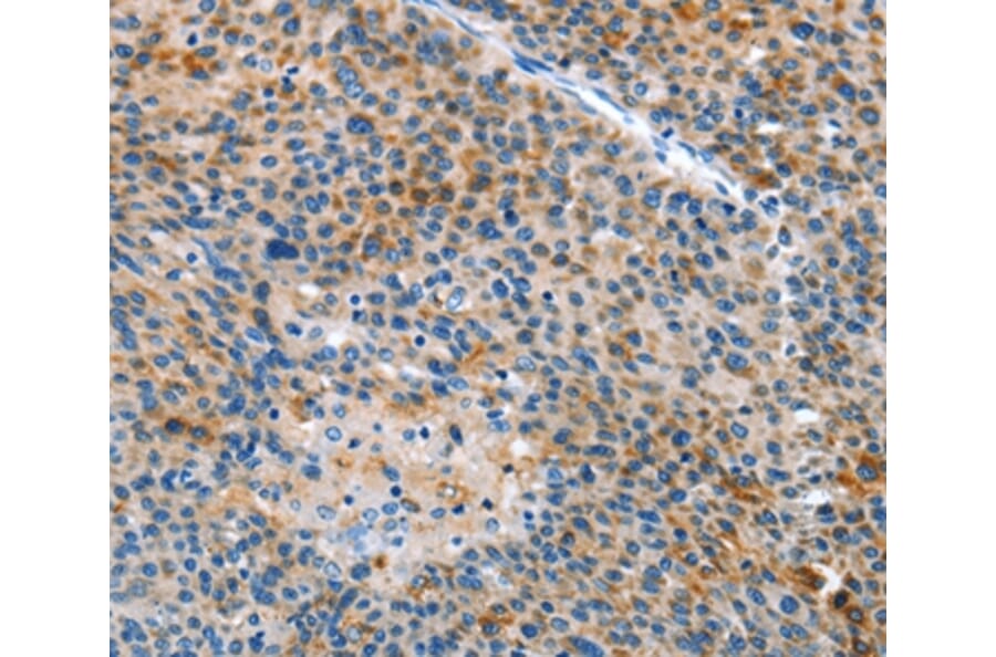 Immunohistochemistry - ALS2 Antibody from Signalway Antibody (36087) - Antibodies.com