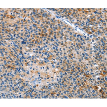 Immunohistochemistry - ALS2 Antibody from Signalway Antibody (36087) - Antibodies.com