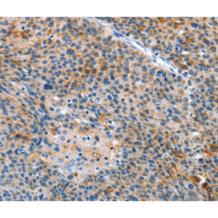 Immunohistochemistry - ALS2 Antibody from Signalway Antibody (36087) - Antibodies.com