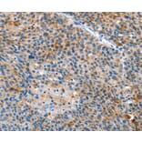 Immunohistochemistry - ALS2 Antibody from Signalway Antibody (36087) - Antibodies.com