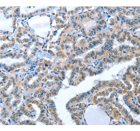 Immunohistochemistry - ACE2 Antibody from Signalway Antibody (36103) - Antibodies.com