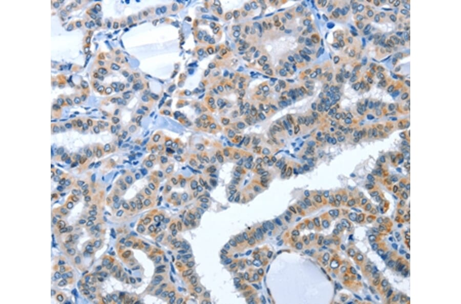 Immunohistochemistry - ACE2 Antibody from Signalway Antibody (36103) - Antibodies.com