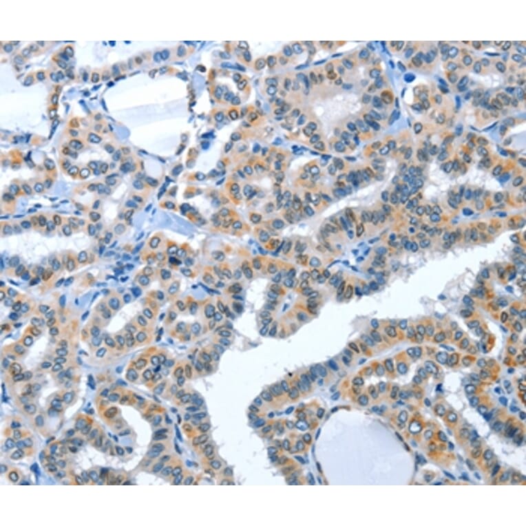 Immunohistochemistry - ACE2 Antibody from Signalway Antibody (36103) - Antibodies.com