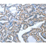 Immunohistochemistry - ACE2 Antibody from Signalway Antibody (36103) - Antibodies.com