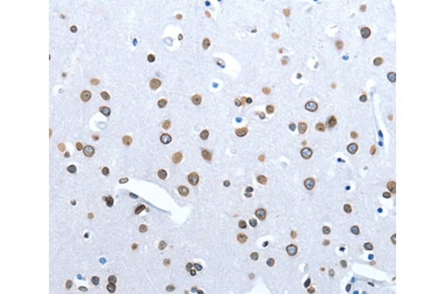 Immunohistochemistry - ACE2 Antibody from Signalway Antibody (36103) - Antibodies.com