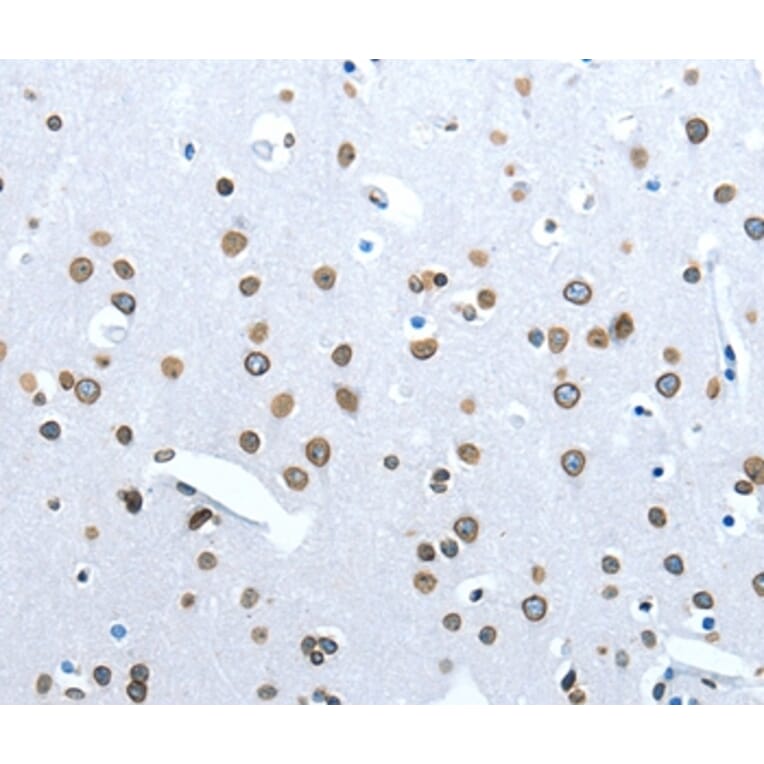 Immunohistochemistry - ACE2 Antibody from Signalway Antibody (36103) - Antibodies.com