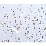 Immunohistochemistry - ACE2 Antibody from Signalway Antibody (36103) - Antibodies.com