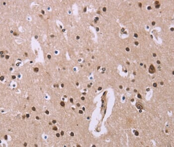 Immunohistochemical analysis of paraffin-embedded Human brain tissue using #36104 at dilution 1/20.