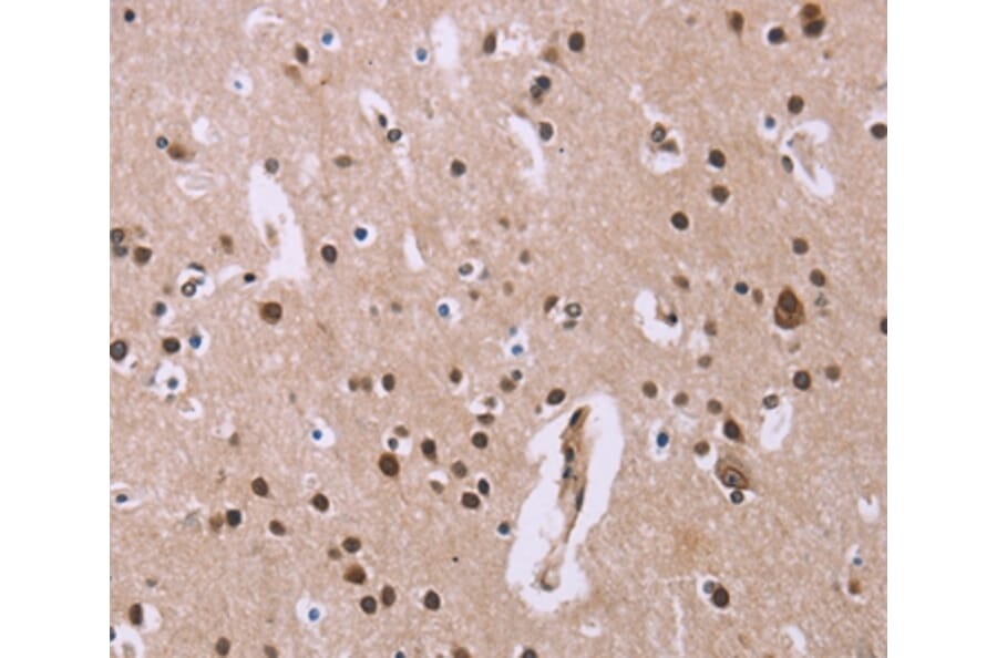 Immunohistochemistry - ANLN Antibody from Signalway Antibody (36104) - Antibodies.com