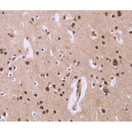 Immunohistochemistry - ANLN Antibody from Signalway Antibody (36104) - Antibodies.com