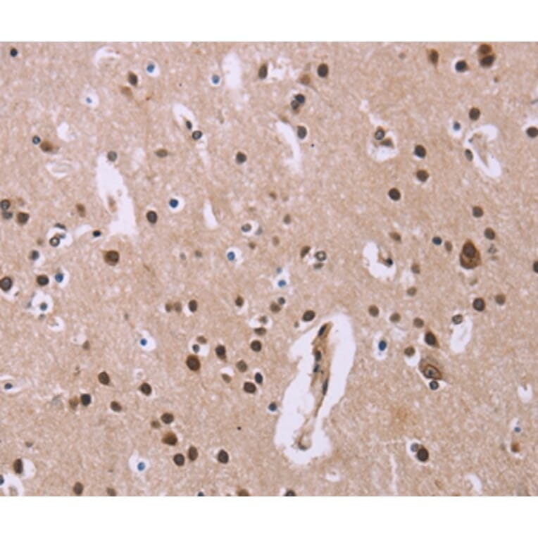 Immunohistochemistry - ANLN Antibody from Signalway Antibody (36104) - Antibodies.com
