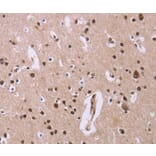 Immunohistochemistry - ANLN Antibody from Signalway Antibody (36104) - Antibodies.com