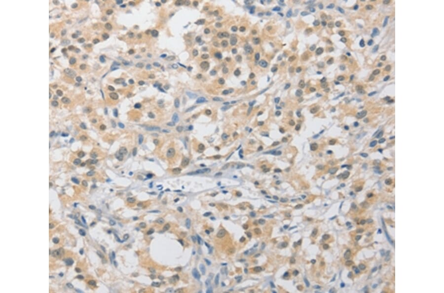 Immunohistochemistry - APLF Antibody from Signalway Antibody (36118) - Antibodies.com