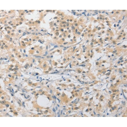Immunohistochemistry - APLF Antibody from Signalway Antibody (36118) - Antibodies.com