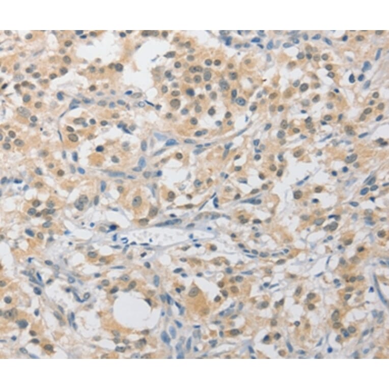 Immunohistochemistry - APLF Antibody from Signalway Antibody (36118) - Antibodies.com