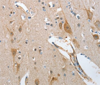 Immunohistochemical analysis of paraffin-embedded Human brain tissue using #36121 at dilution 1/35.