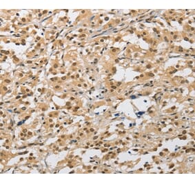 Immunohistochemistry - AMZ2 Antibody from Signalway Antibody (36126) - Antibodies.com