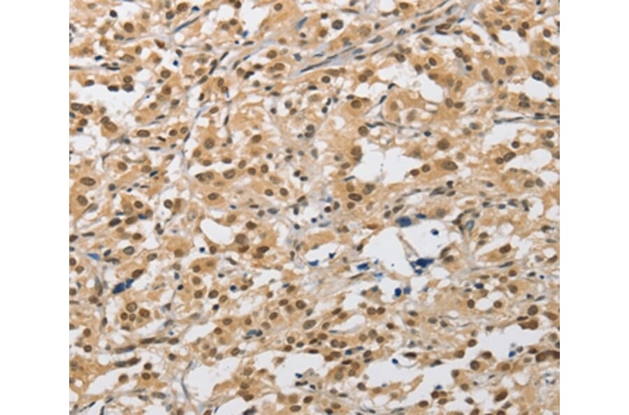 Immunohistochemistry - AMZ2 Antibody from Signalway Antibody (36126) - Antibodies.com