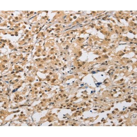 Immunohistochemistry - AMZ2 Antibody from Signalway Antibody (36126) - Antibodies.com