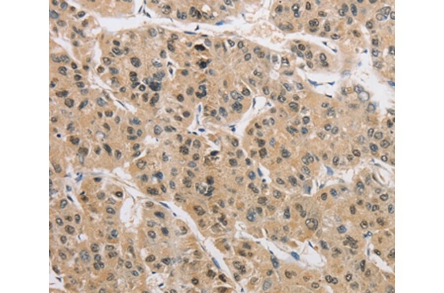 Immunohistochemistry - AMZ2 Antibody from Signalway Antibody (36126) - Antibodies.com