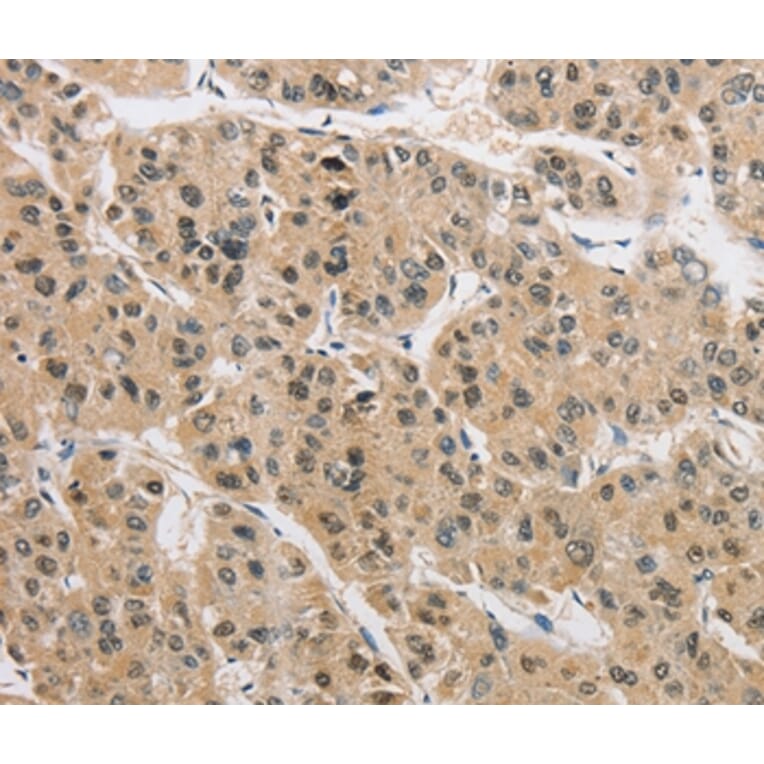 Immunohistochemistry - AMZ2 Antibody from Signalway Antibody (36126) - Antibodies.com